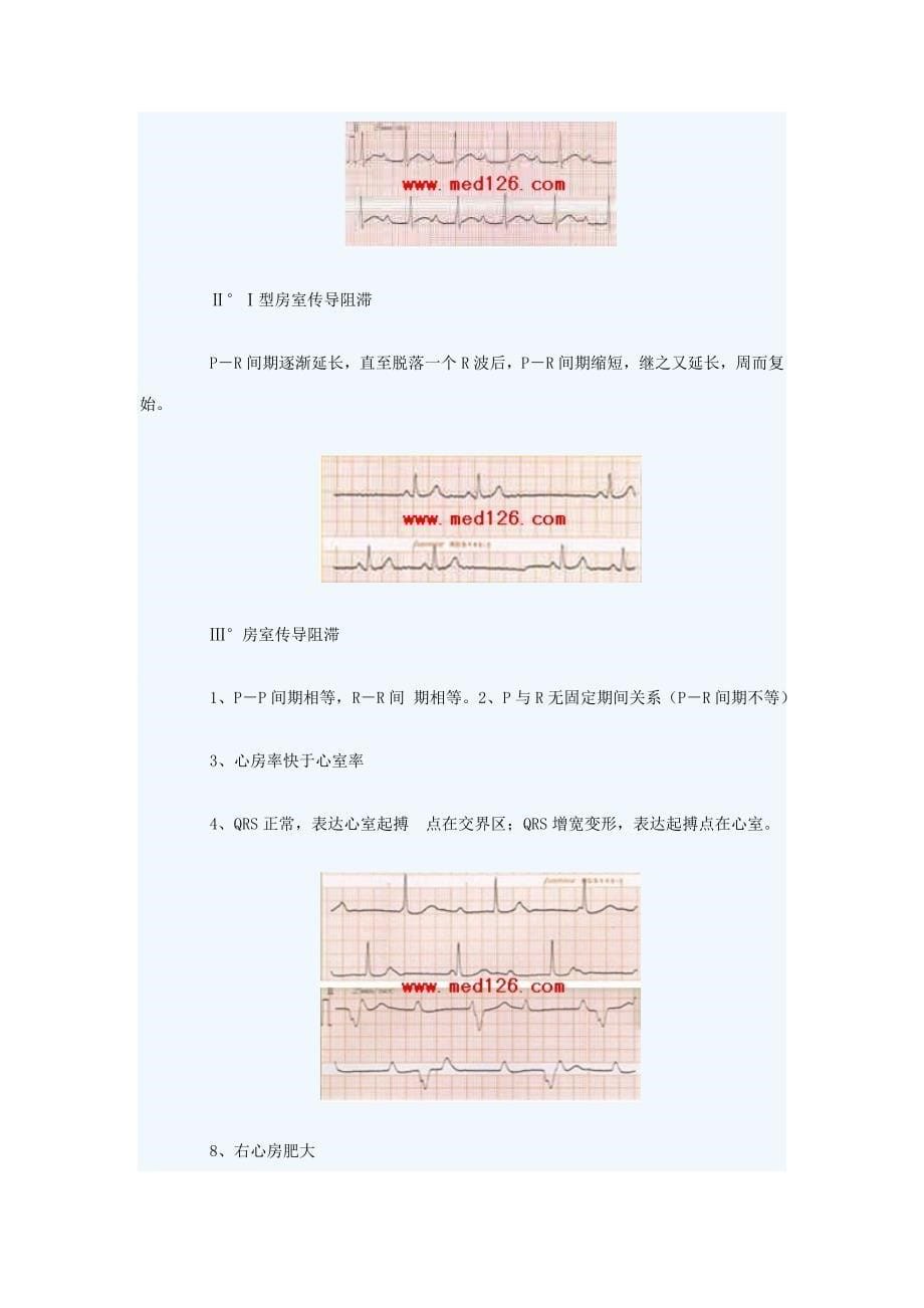 2023年执业医师实践技能考试心电图部分.doc_第5页