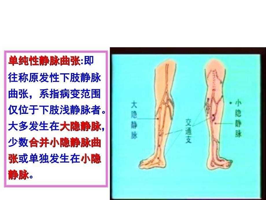 《周围血管疾病病人的护理》_第5页