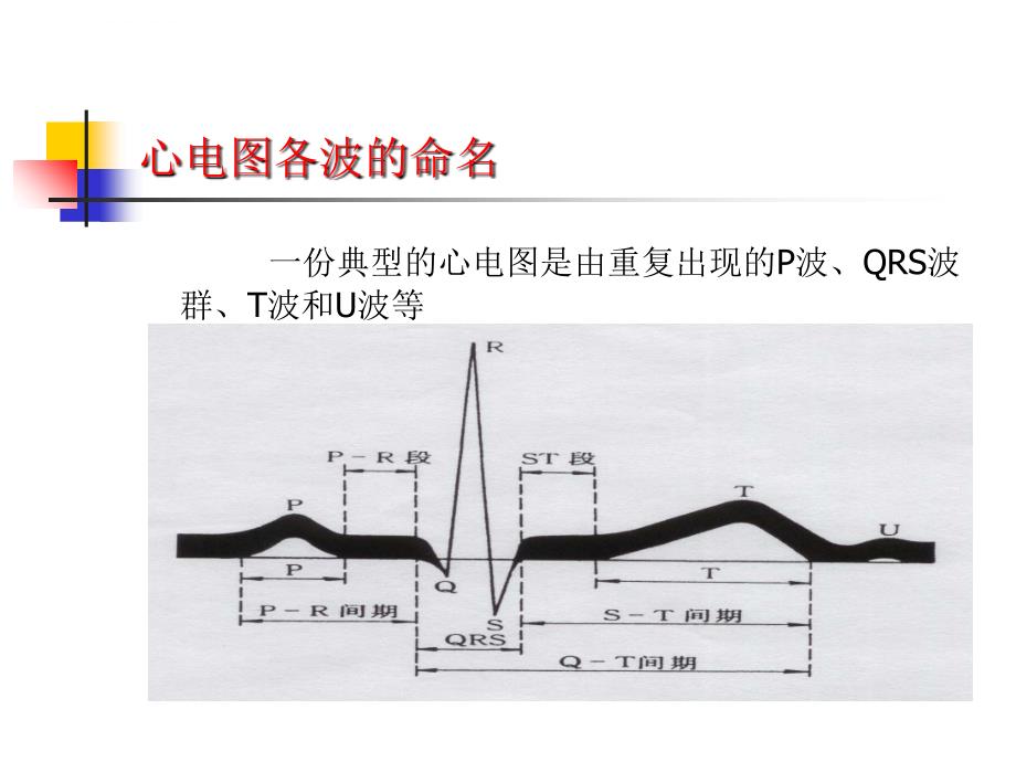 临床常见心电图的判读ppt课件_第2页