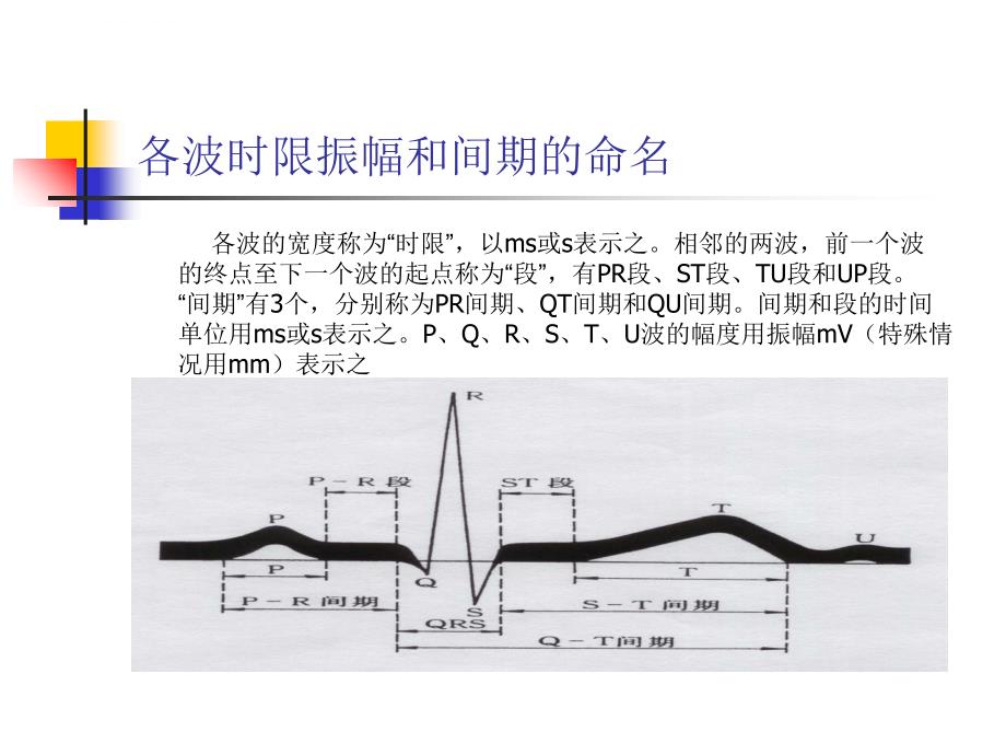 临床常见心电图的判读ppt课件_第3页