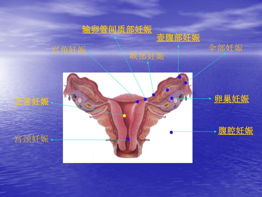 妇科急腹痛诊治思路_第3页