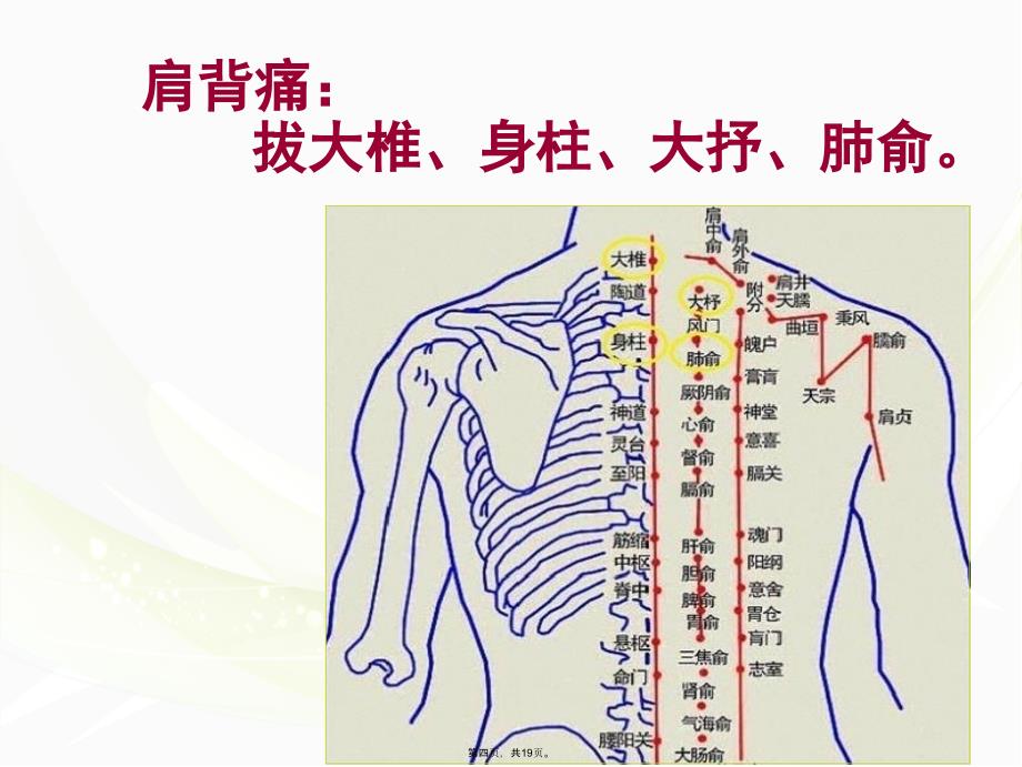 中医康复保健培训课件--拔罐教学教材_第4页