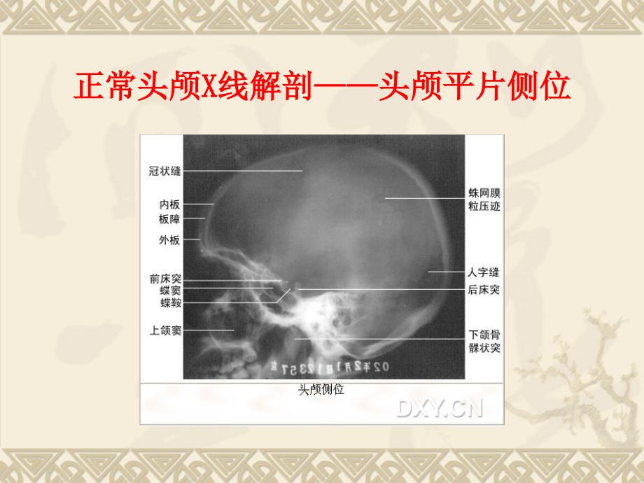 《医学X线正常解剖》PPT课件_第2页