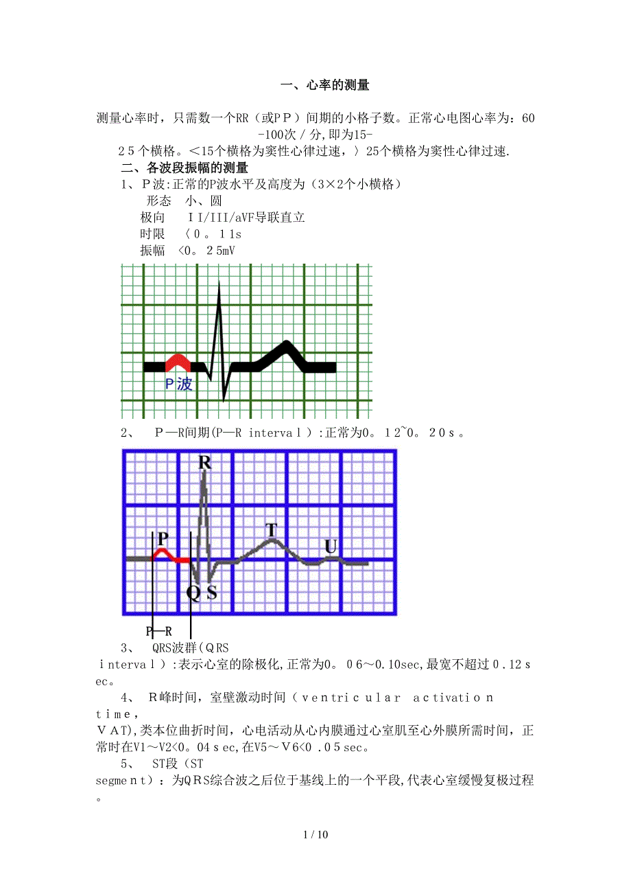 典型心电图详细讲解_第1页