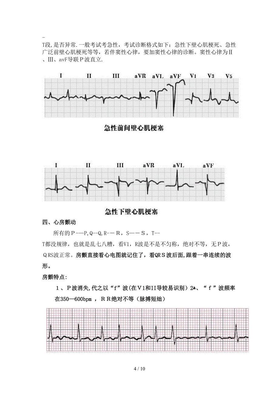 典型心电图详细讲解_第4页