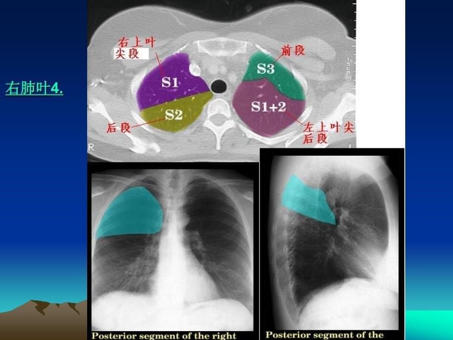 CT正常彩色解剖图谱_第5页