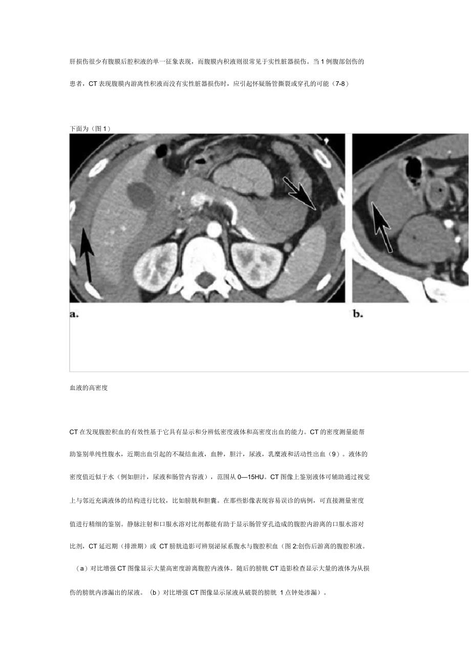 腹部出血：腹腔积血的CT表现_第3页