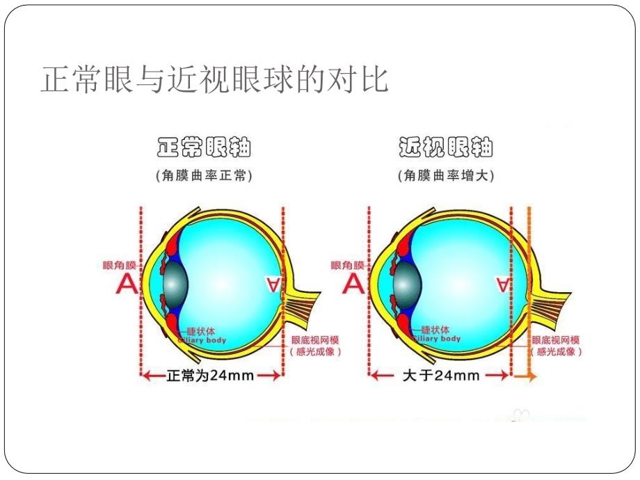 配戴OK镜的利弊_第3页