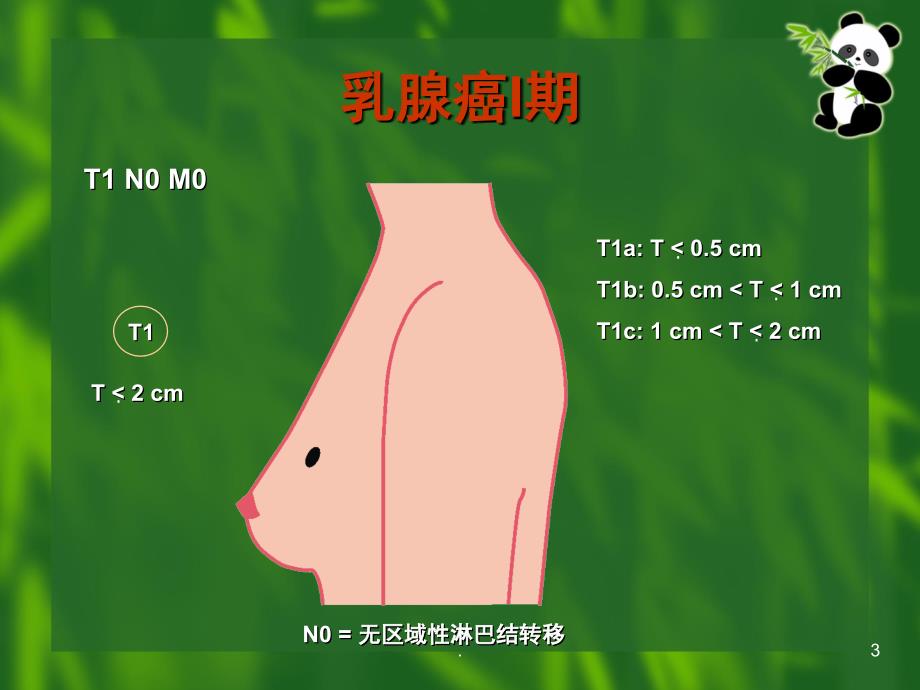 乳腺癌TNM分期课堂PPT_第3页