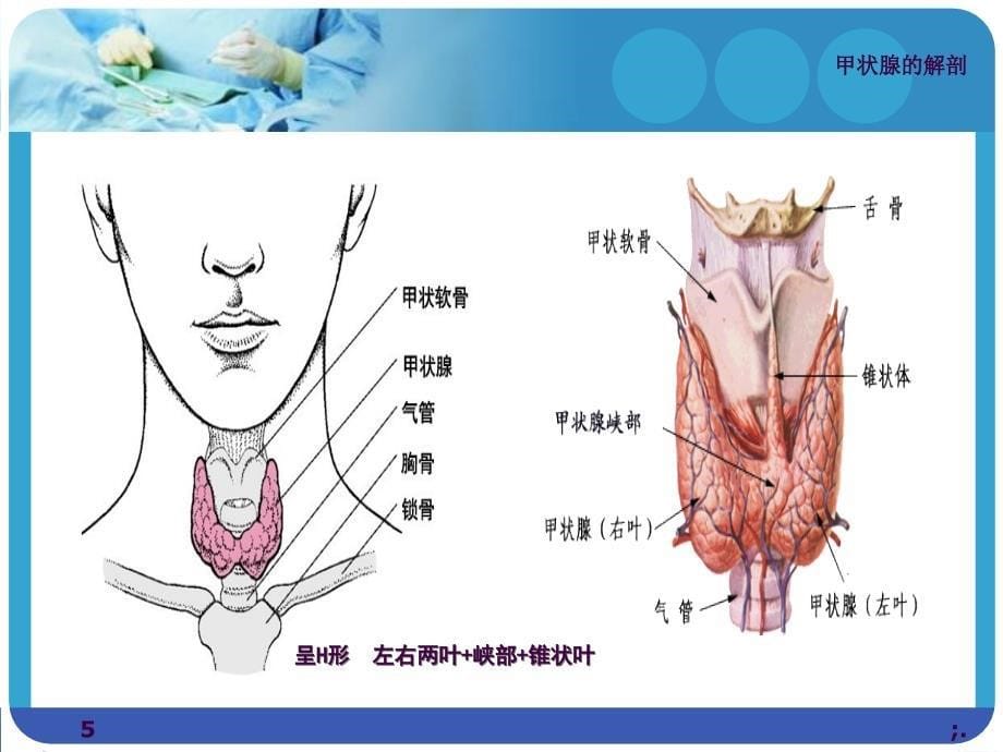 腔镜下甲状腺手术的护理查房ppt课件_第5页