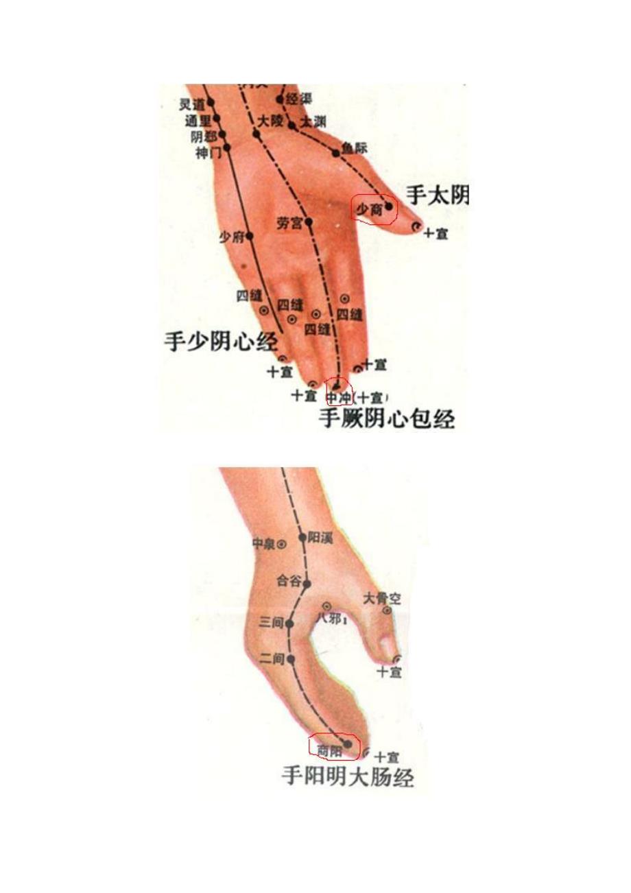 脑中风(景昌)放血救命绝技【附图】.doc_第4页