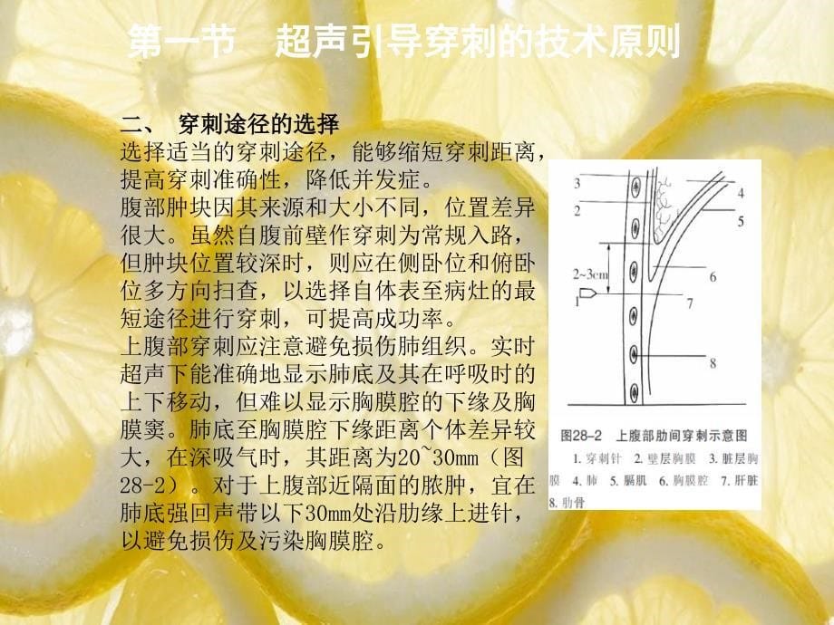 第二十八章介入性超声_第5页