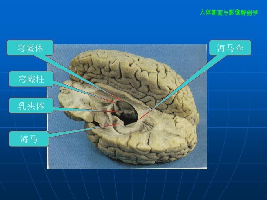 大脑解剖结构入门四邯郸市中心医院_第5页