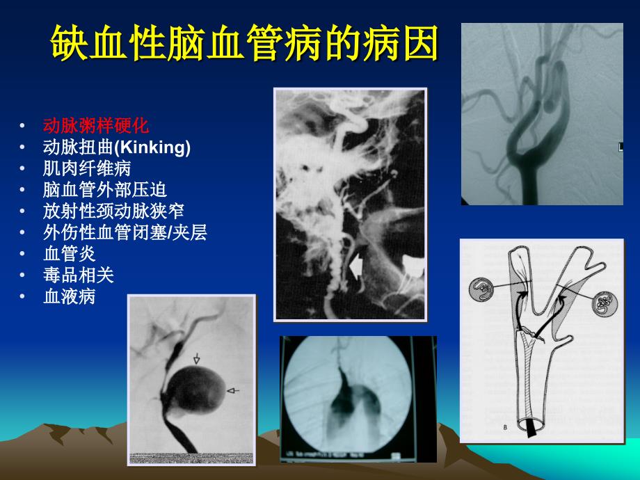 病因分型成都ppt课件_第3页