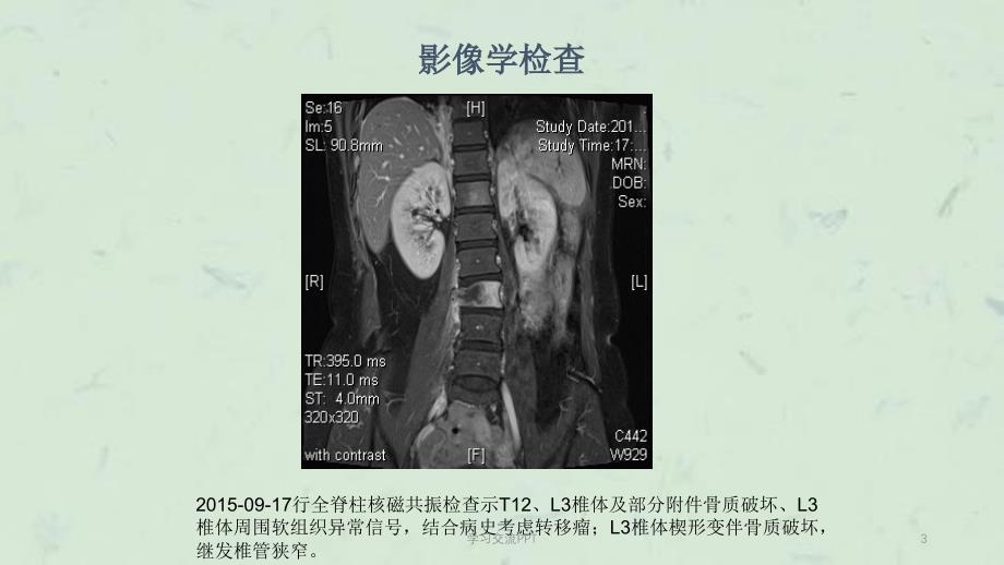 癌痛病例课件_第3页