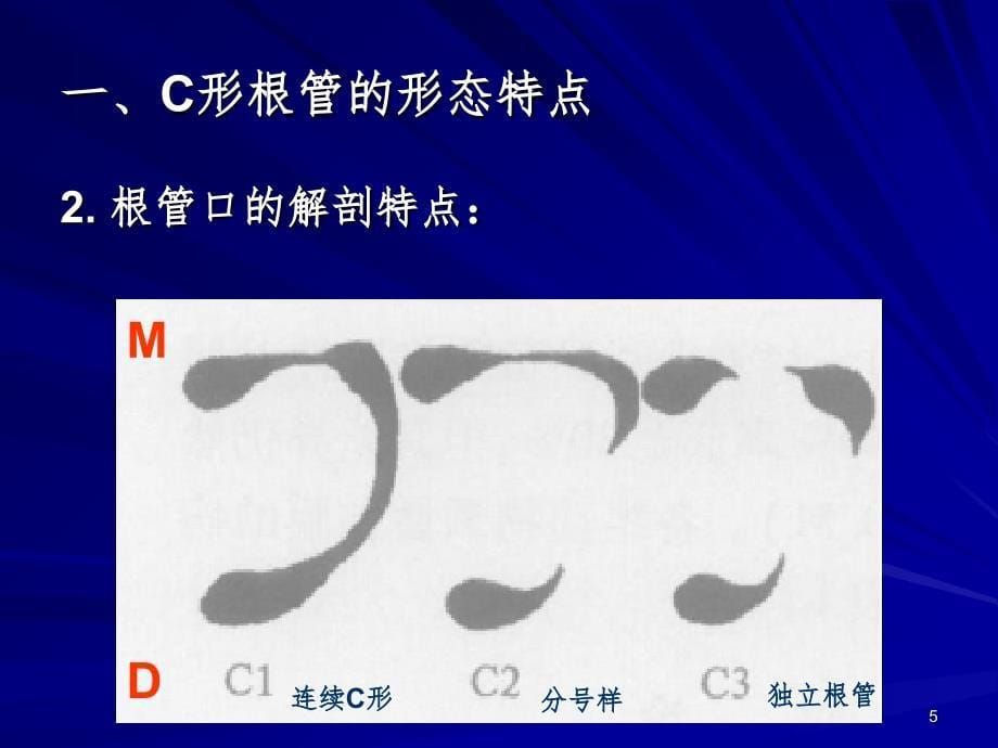 C形根管的形态识别和治疗.ppt_第5页