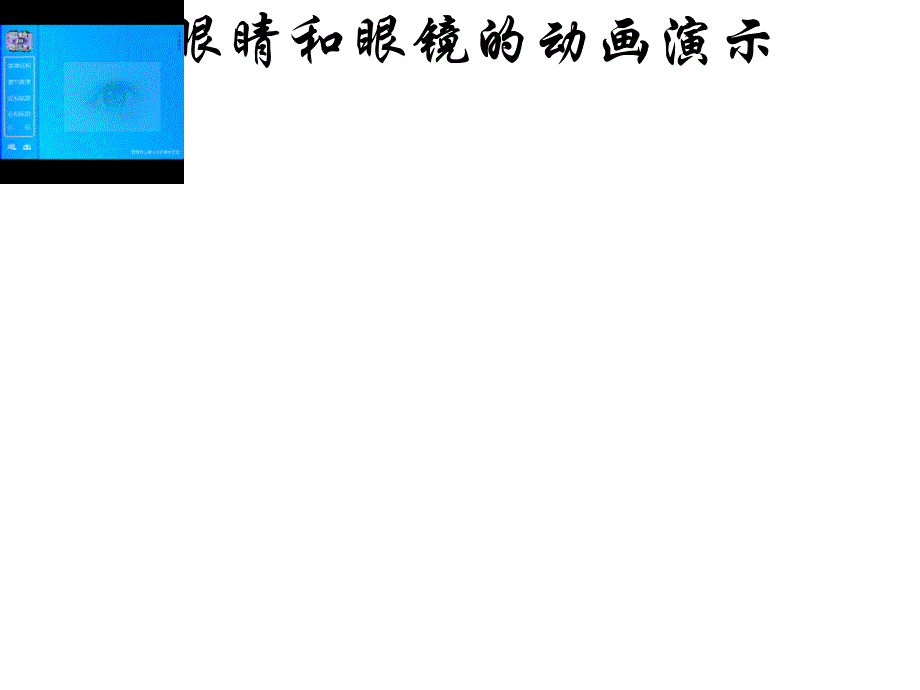 第六节眼睛与视力矫正_第3页