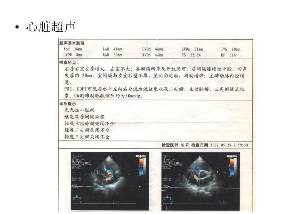 房间隔缺损合并心肌病的治疗教学课件_第3页