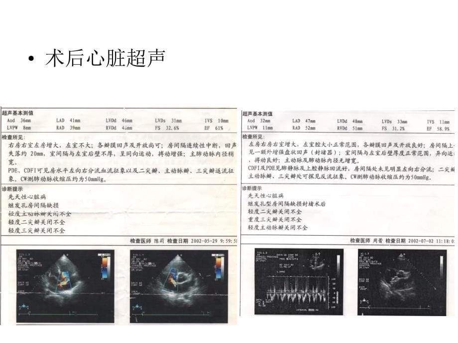 房间隔缺损合并心肌病的治疗教学课件_第5页