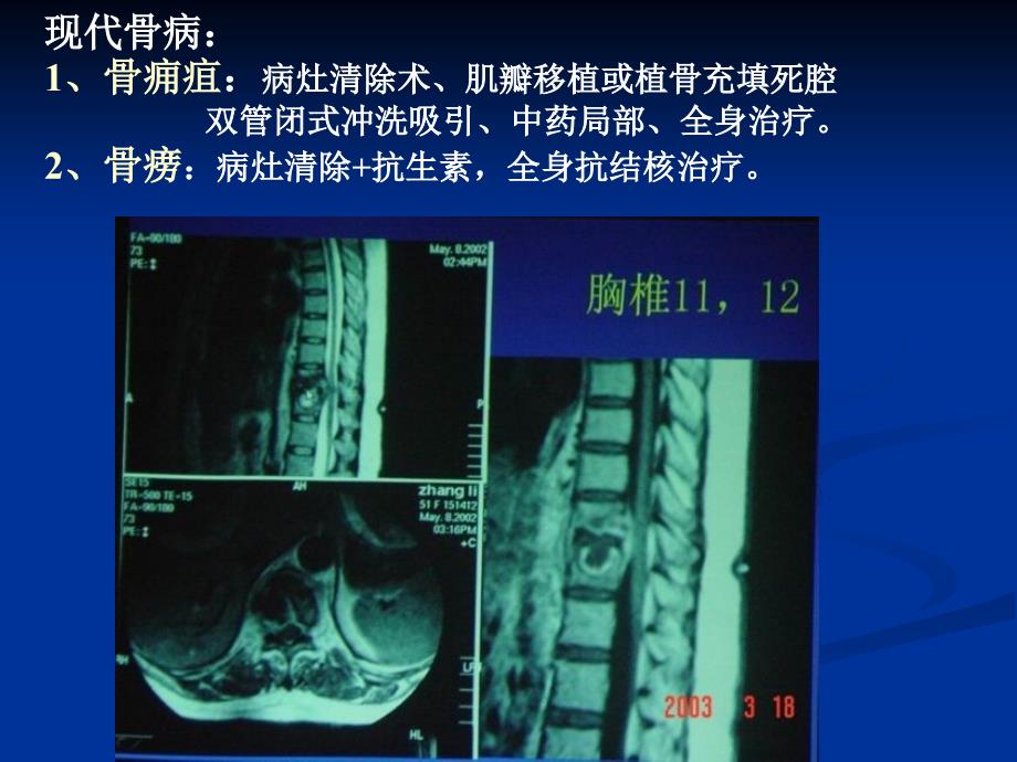 中医骨病学总论课件文档资料_第3页