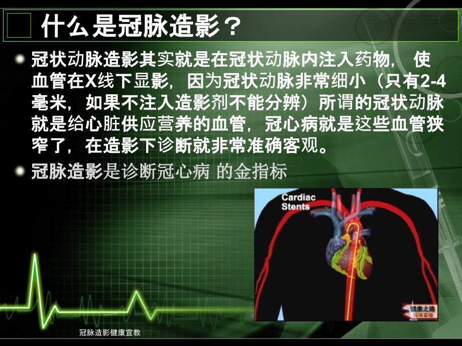 最新冠脉造影健康宣教_第2页