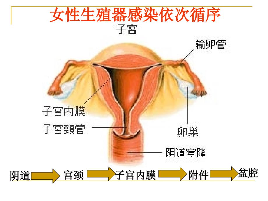 医学专题：宫颈炎、附件炎、盆腔炎..._第3页