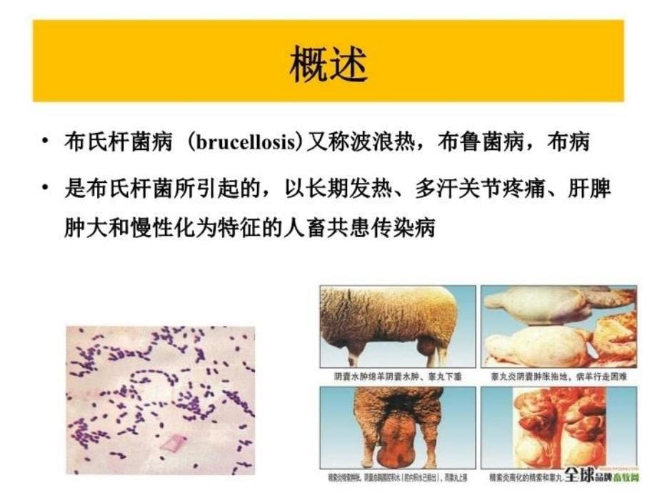 最新布氏杆菌病戴军有PPT课件_第5页