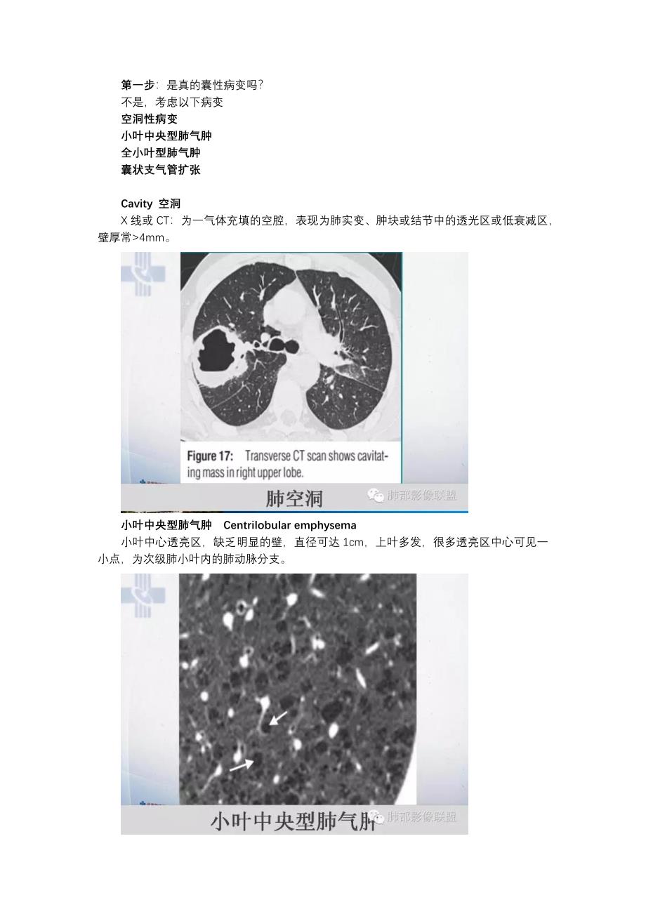 肺部囊性病变的诊断和鉴别诊断_第3页