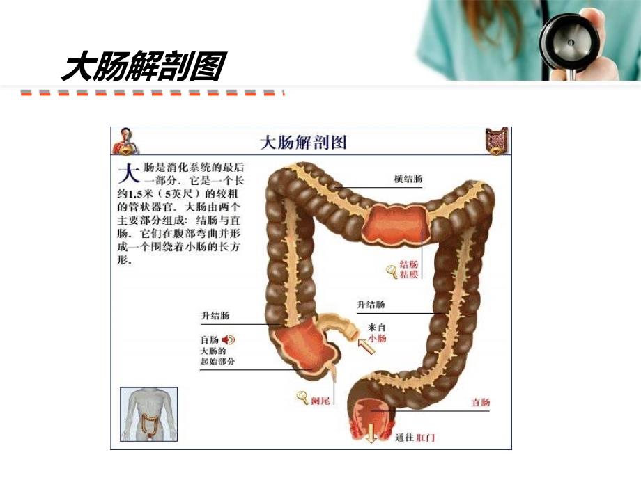 个案分析直肠癌_第3页