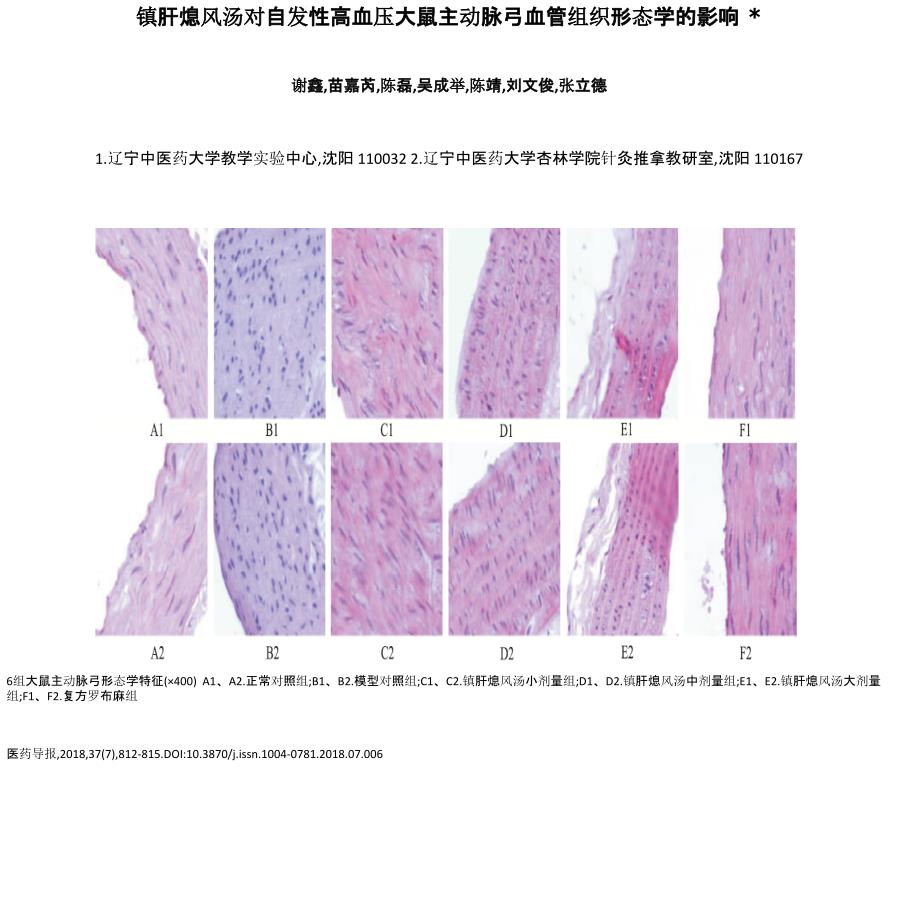 镇肝熄风汤对自发性高血压大鼠主动脉弓血管组织形态学的影_第1页