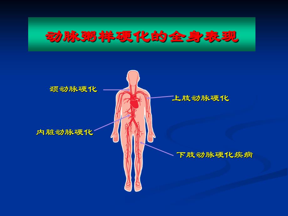 下肢动脉硬化闭塞症介入治疗_第3页