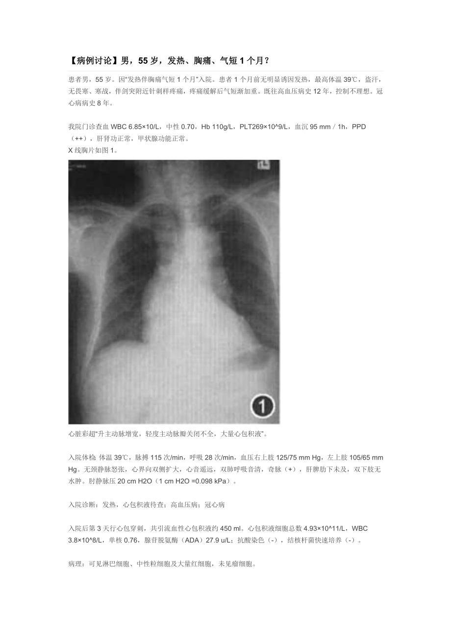 主动脉夹层病历分析 (2).doc_第1页