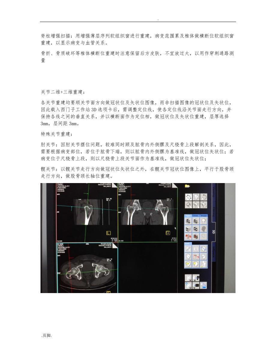 CT三维重建的指南_第4页