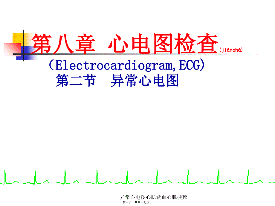 异常心电图心肌缺血心肌梗死课件_第1页