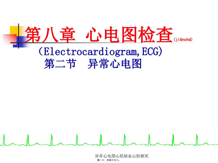 异常心电图心肌缺血心肌梗死课件