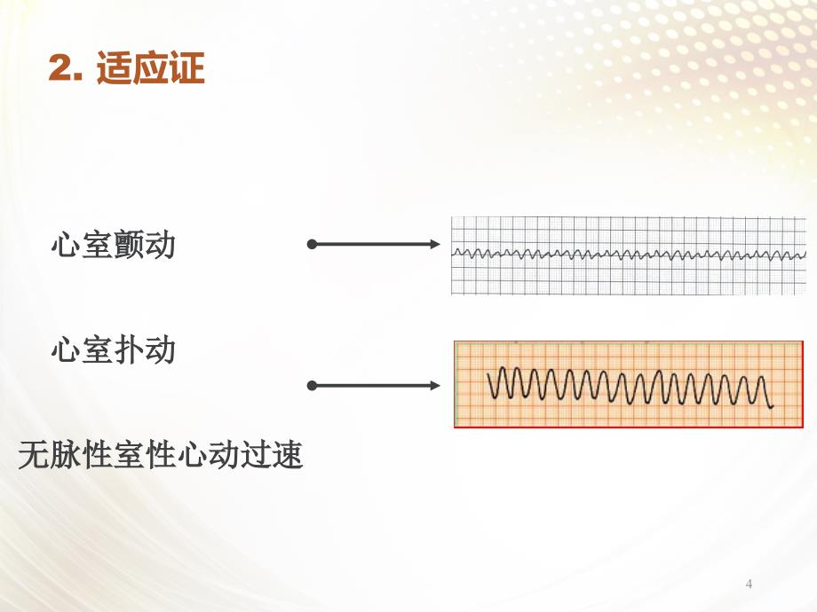 （参考课件）心脏电除颤术.ppt_第4页