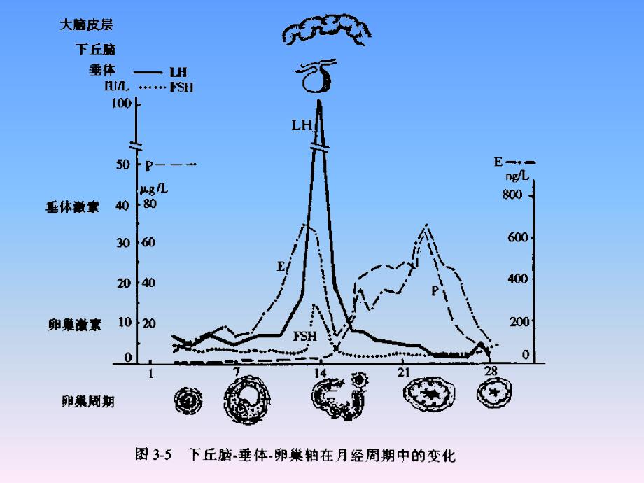 妇产科学教学课件：功能失调性子宫出血1_第4页