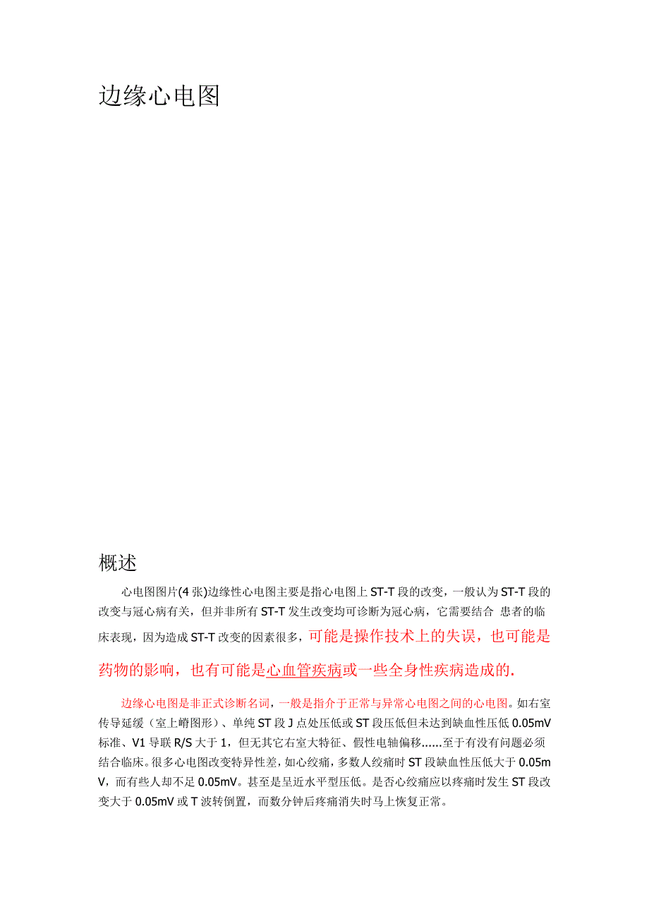 边缘心电图Microsoft Word 文档.doc_第1页