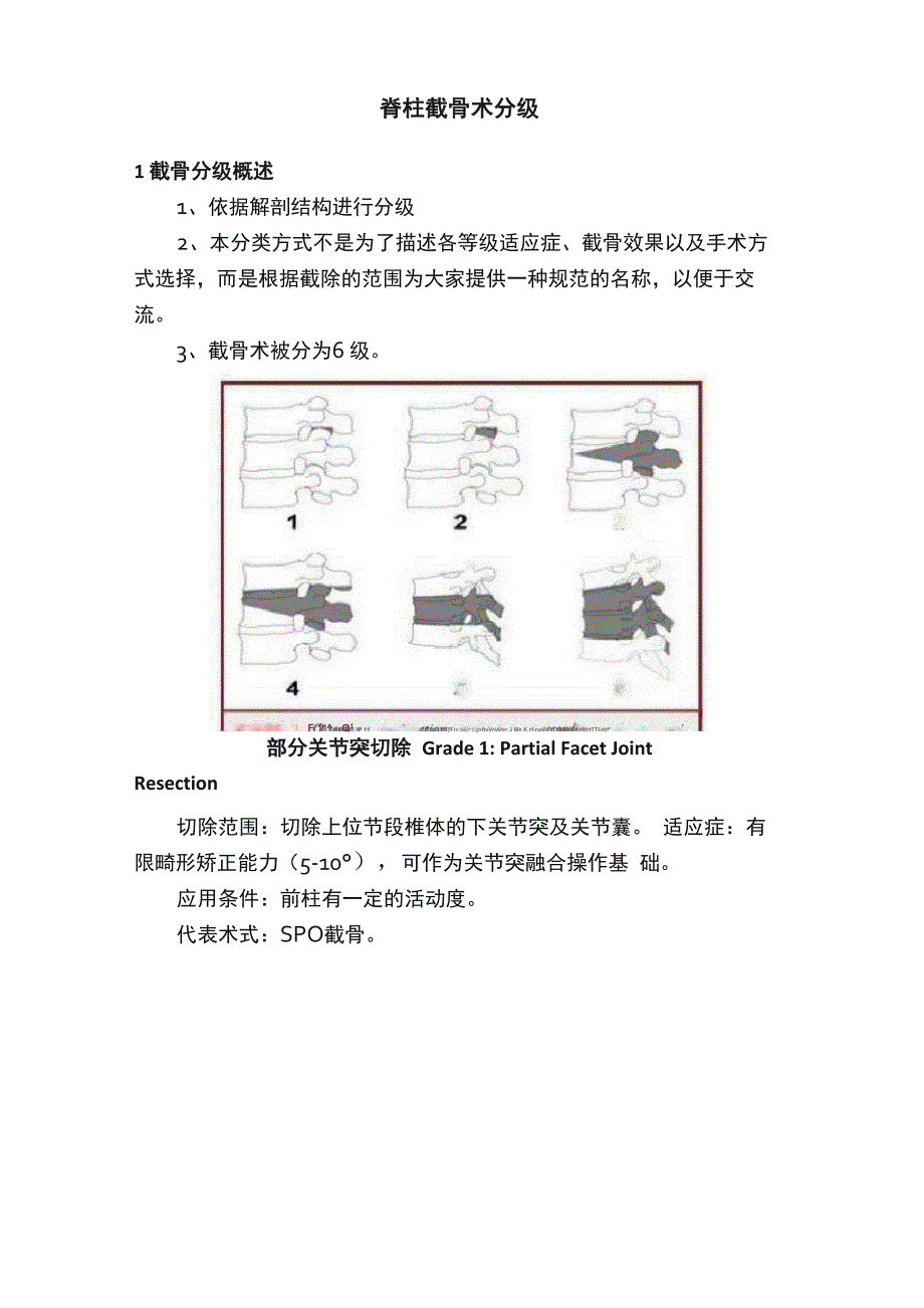 脊柱截骨术分级_第1页