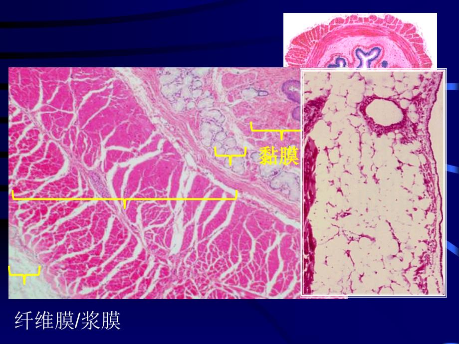 中空性器管ppt_第3页