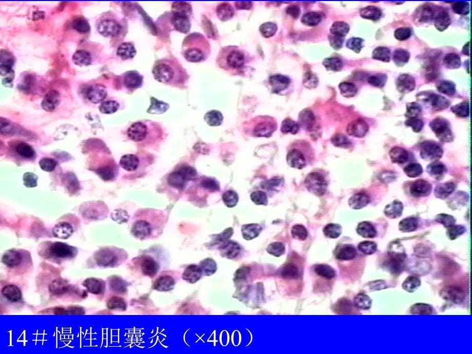 病理学教学及实验(附大量图片)复习课程_第5页