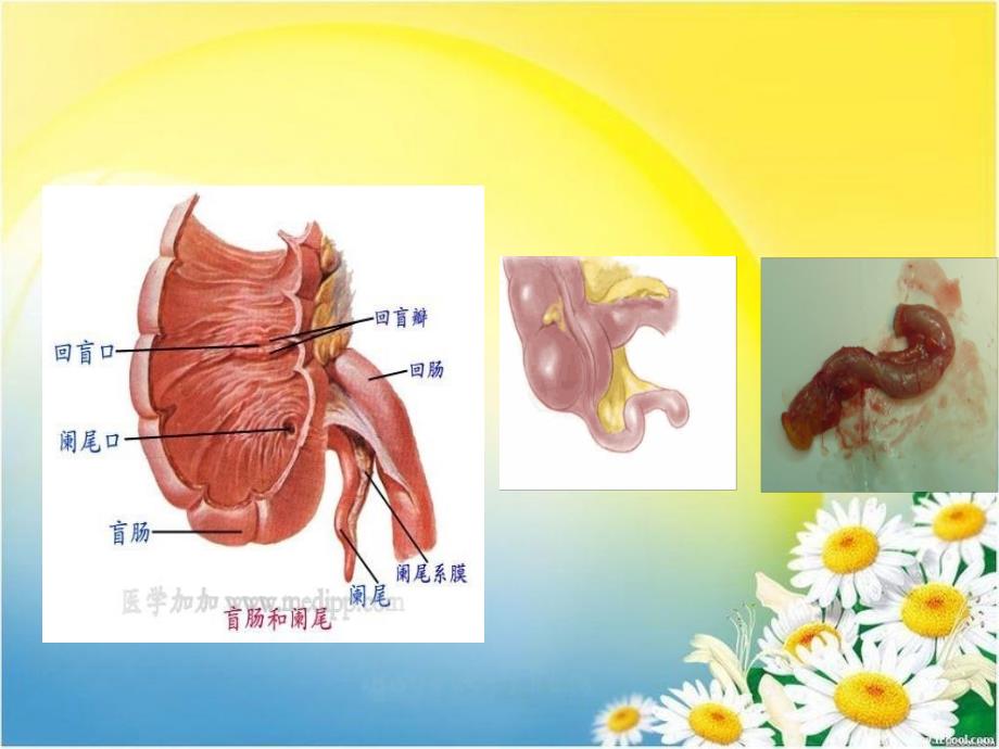 阑尾解剖生理_第3页