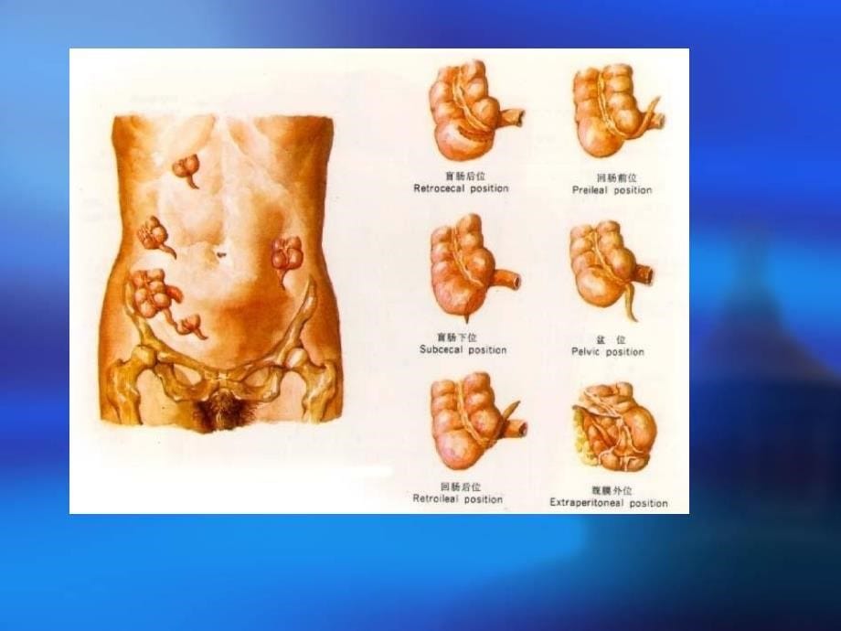 阑尾解剖生理_第5页