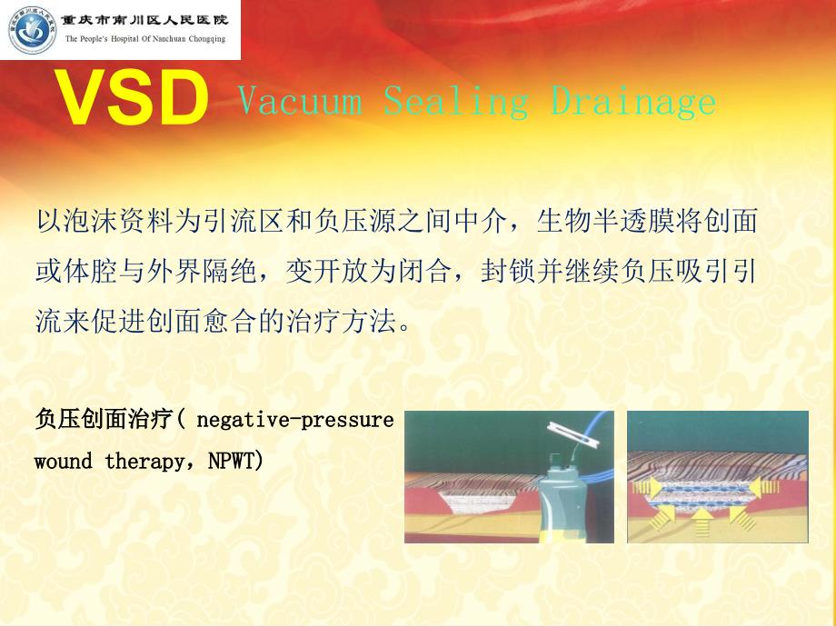 VSD技术的临床应用ppt课件_第3页