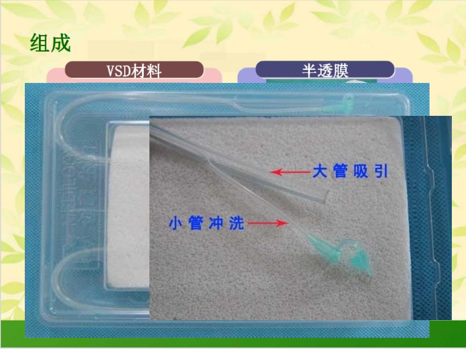 VSD技术的临床应用ppt课件_第4页