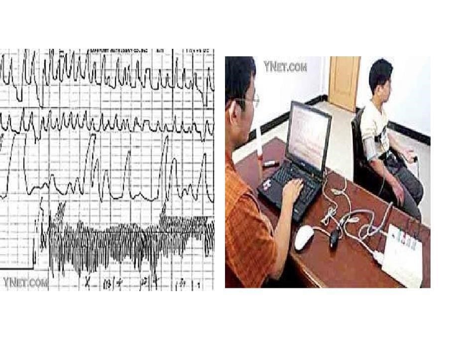 精编)《临床心理学》双语教学精品课件chapter5defineandmeasurestressII_第5页