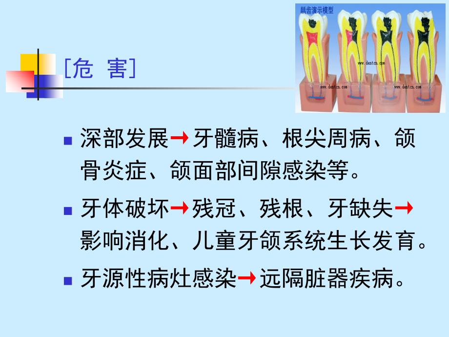 龋病病因、临床表现、诊断、鉴别诊断_第4页