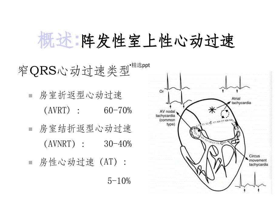 快速性心律失常处理原则课件_第5页