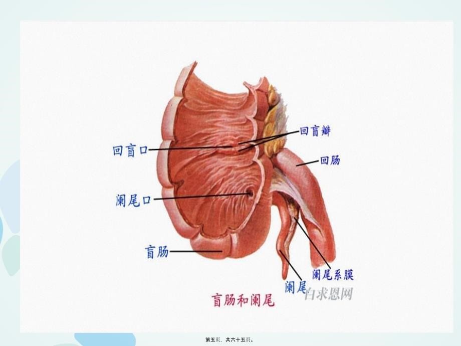 急腹症--广州市花都区人民医院课件_第5页