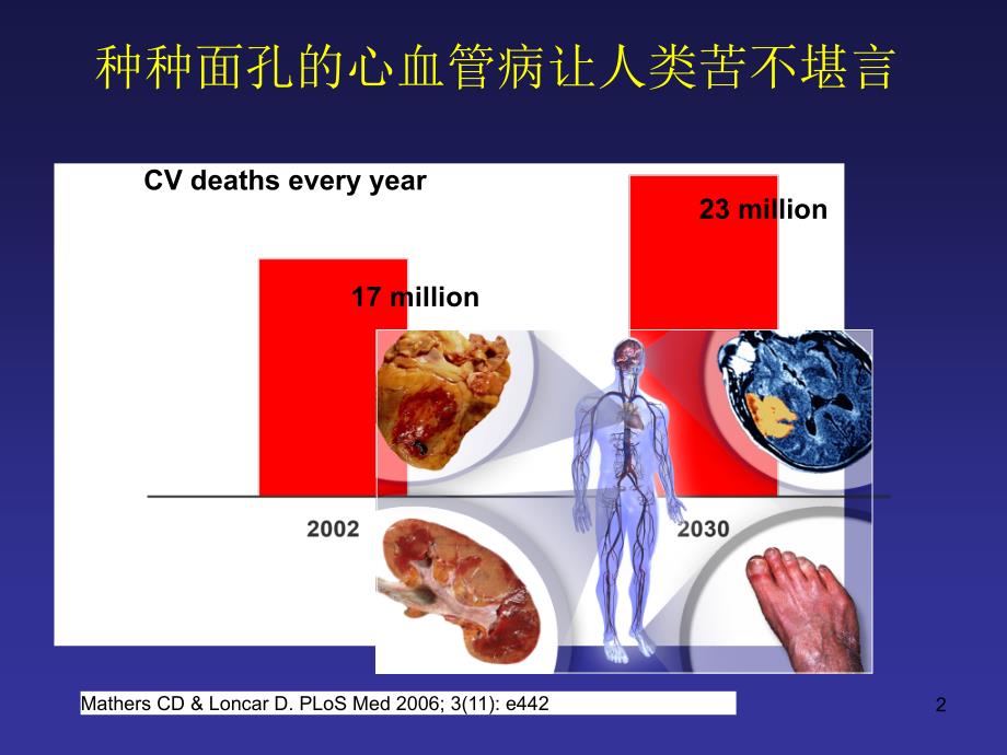 心血管病传统和新危险因素评价参考PPT_第2页